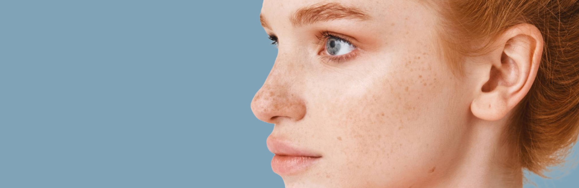 Sensitive Skin
